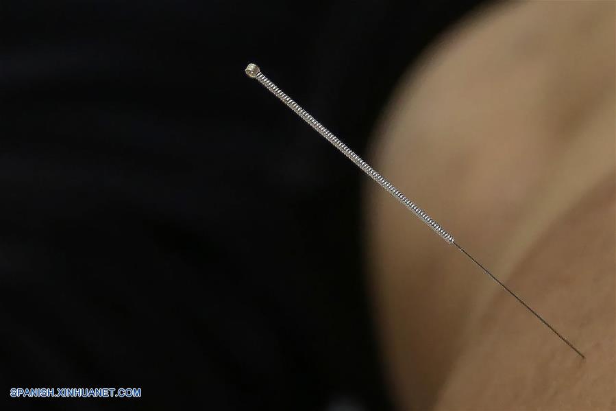 De acuerdo con la OMS, 103 miembros han dado su aprobación a la práctica de la acupuntura y moxibustiónints, con 29 que han decretado estatutos especiales en medicina tradicional, y 18 que incluyeron los tratamientos de acupuntura y moxibustión en sus provisiones de seguro médico.