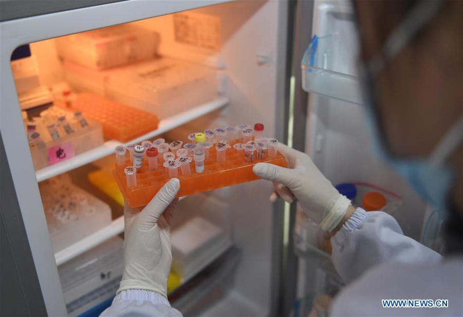 CHINA-CHENGDU-CORONAVIRUS-KITS-SUMINISTRO