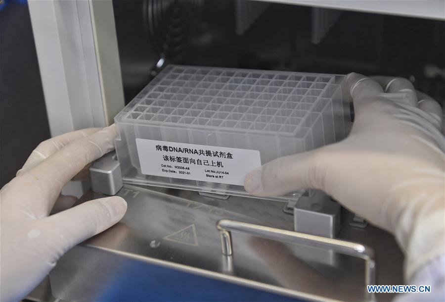 CHINA-CHENGDU-CORONAVIRUS-KITS-SUMINISTRO