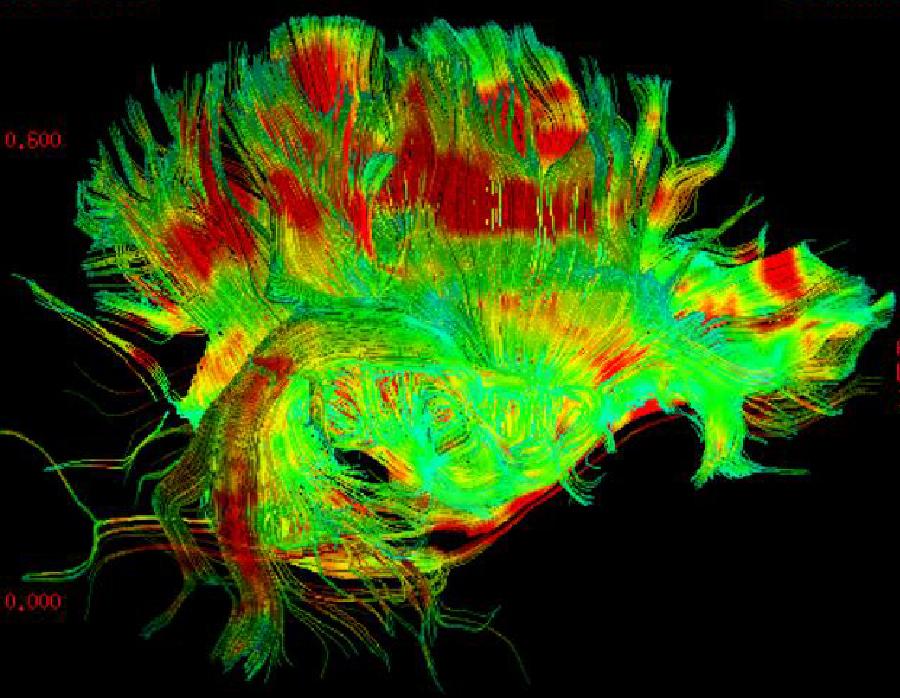 La foto, que fue tomada por un hospital de Chongqing, suroeste de China, muestra las c&eacute;lulas engrandecidas 1.600 veces bajo microscopio. La tecnolog&iacute;a se aplica principalmente en intervenci&oacute;n quir&uacute;rgica. 