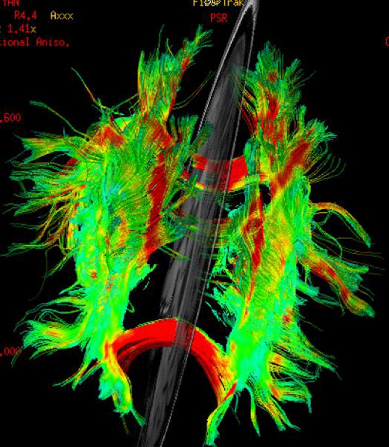 La foto, que fue tomada por un hospital de Chongqing, suroeste de China, muestra las c&eacute;lulas engrandecidas 1.600 veces bajo microscopio. La tecnolog&iacute;a se aplica principalmente en intervenci&oacute;n quir&uacute;rgica. 