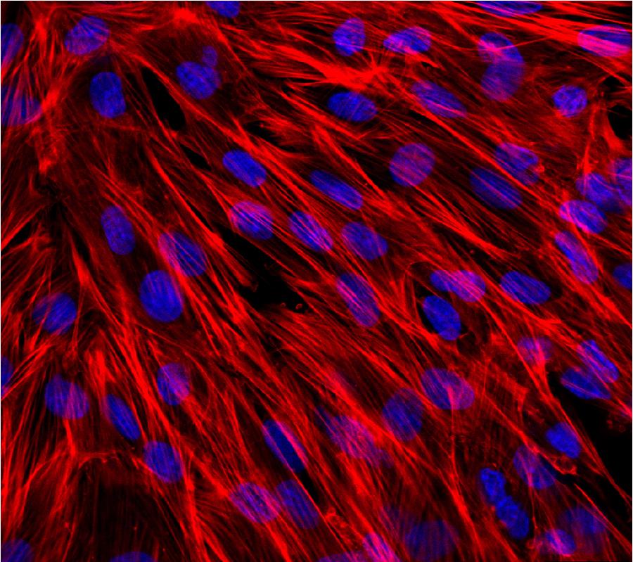 La foto, que fue tomada por un hospital de Chongqing, suroeste de China, muestra las c&eacute;lulas engrandecidas 1.600 veces bajo microscopio. La tecnolog&iacute;a se aplica principalmente en intervenci&oacute;n quir&uacute;rgica. 