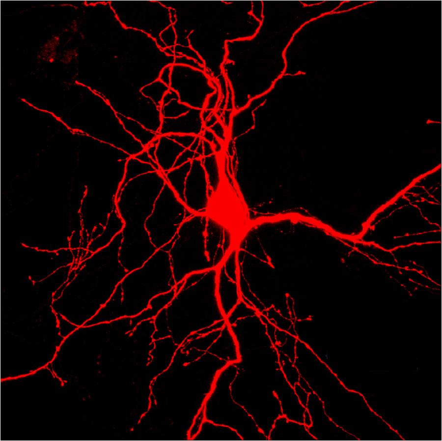 La foto, que fue tomada por un hospital de Chongqing, suroeste de China, muestra las c&eacute;lulas engrandecidas 1.600 veces bajo microscopio. La tecnolog&iacute;a se aplica principalmente en intervenci&oacute;n quir&uacute;rgica. 
