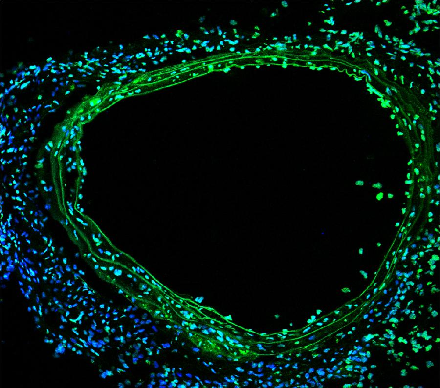 La foto, que fue tomada por un hospital de Chongqing, suroeste de China, muestra las c&eacute;lulas engrandecidas 1.600 veces bajo microscopio. La tecnolog&iacute;a se aplica principalmente en intervenci&oacute;n quir&uacute;rgica. 