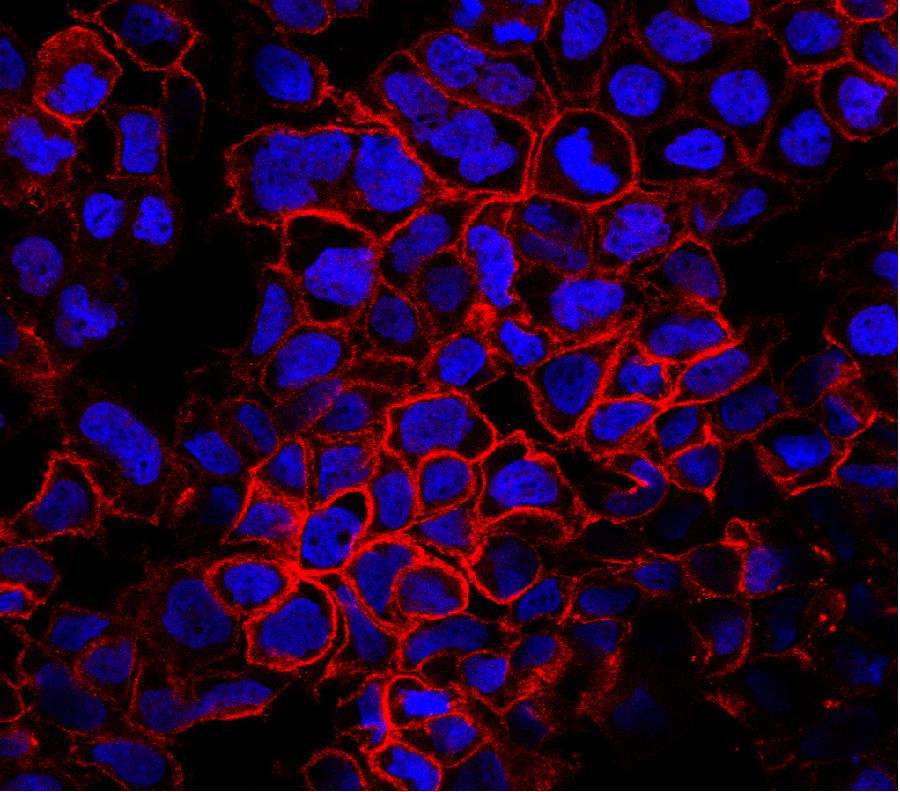 La foto, que fue tomada por un hospital de Chongqing, suroeste de China, muestra las c&eacute;lulas engrandecidas 1.600 veces bajo microscopio. La tecnolog&iacute;a se aplica principalmente en intervenci&oacute;n quir&uacute;rgica. 