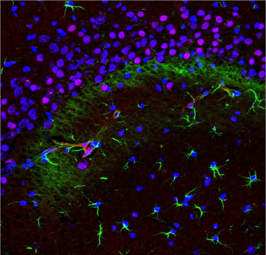 La foto, que fue tomada por un hospital de Chongqing, suroeste de China, muestra las c&eacute;lulas engrandecidas 1.600 veces bajo microscopio. La tecnolog&iacute;a se aplica principalmente en intervenci&oacute;n quir&uacute;rgica. 