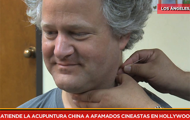 Atende la acupuntura china a afamados cineastas en Hollywood