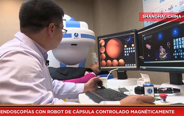 Endoscopías con robot de cápsula controlado magnéticamente